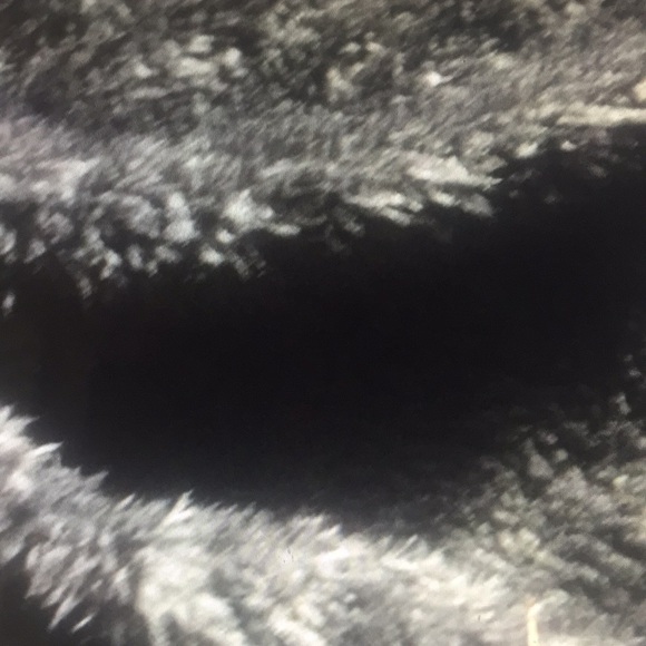 Restocked 5⭐️2 pieces Set - Picture 2 of 5